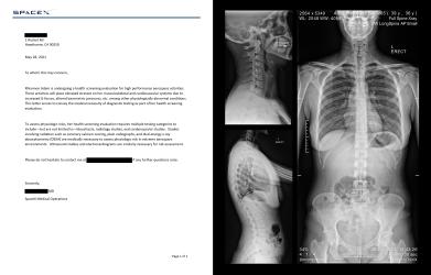 Long Spine X-Ray and Medical Necessity Letter