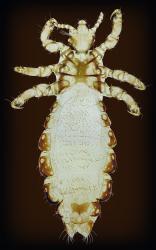 Head Louse (20x)
